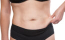 Mini Tummy Tuck
